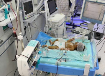 PICC置管日渐成熟