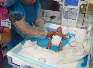 新生儿机械通气广泛开展