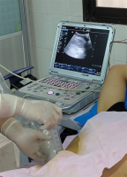 肾脏内科为慢性肾衰竭合并HIV患者实施腹膜透析置管术