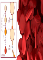 会遗传的“腹痛”：贵医附院消化内科成功诊断治疗一例罕见“卟啉病”