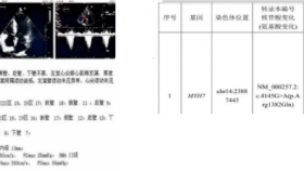贵医附院心肌病中心开出贵州首张肥厚型心肌病靶向药物处方